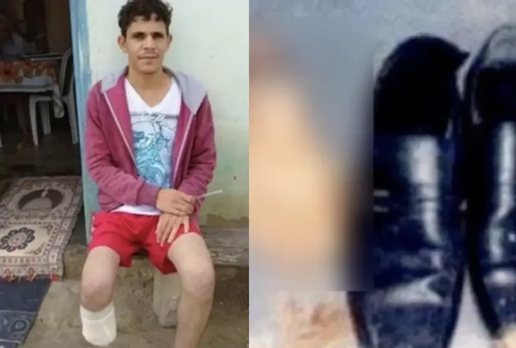 Homem que tentou receber R$ 1,5 milhão em seguros guardou pé amputado dentro da própria mochila servidor amputa pe 1024x691 1