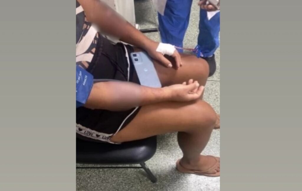 Produto corrosivo usado para desentupir pia atinge quarto e deixa mãe e criança feridas em Cajazeiras IMG 20260910 123143 711