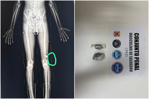 Funcionário é preso com drogas em presídio de Salvador body scan flagrou tentativa de entrar com droga 3420299 article